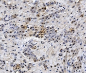 IHC staining of FFPE human placenta with HMGB3 antibody. HIER: boil tissue sections in pH8 EDTA for 20 min and allow to cool before testing.