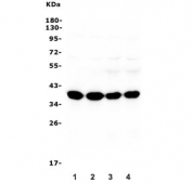Western blot testing of rat brain (lanes 1-2) and mouse brain (lanes 3-4) lysate with Synaptophysin antibody. Predicted molecular weight: 34-38 kDa.