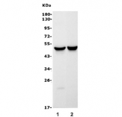 Western blot testing of 1) rat brain and 2) mouse brain lysate with GFAP antibody. Predicted molecular weight ~50 kDa.