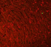 Immunofluorescent staining of FFPE rat brain tissue with GFAP antibody (red) and DAPI nuclear stain (blue). HIER: boil tissue sections in pH8 EDTA for 20 min and allow to cool before testing.