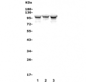 Western blot testing of human 1) MDA-MB-453, 2) U-87 MG and 3) HEK293 lysate with ADAM15 antibody. Expected molecular weight: 93-110 kDa.