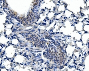 IHC staining of FFPE mouse lung tissue with Adam28 antibody. HIER: boil tissue sections in pH8 EDTA for 20 min and allow to cool before testing.