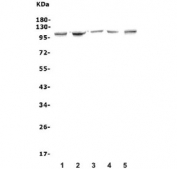 Western blot testing of 1) rat liver, 2) rat PC-12, 3) rat C6, 4) rat RH-35 and 5) mouse liver lysate with Ah Receptor antibody. Predicted molecular weight ~95 kDa.