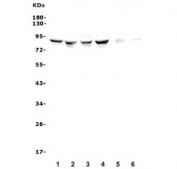 Western blot testing of human 1) HeLa, 2) MDA-MB-453, 3) Caco-2, 4) HEK293, 5) rat heart and 6) mouse skeletal muscle lysate with ALDH18A1 antibody. Predicted molecular weight: 85 kDa.