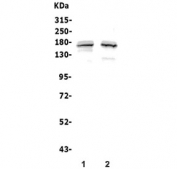 Western blot testing of human 1) COLO-320 and 2) Jurkat lysate with ASXL1 antibody. Predicted molecular weight ~165 kDa.
