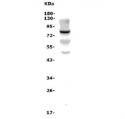 Western blot testing of rat brain lysate with Chat antibody. Predicted molecular weight ~83/74/70 kDa (isoforms M/S/R).