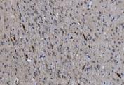 IHC staining of FFPE mouse brain with Chat antibody. HIER: boil tissue sections in pH8 EDTA for 20 min and allow to cool before testing.