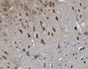 IHC staining of FFPE rat brain with Chat antibody. HIER: boil tissue sections in pH8 EDTA for 20 min and allow to cool before testing.
