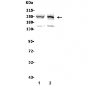 Western blot testing of human 1) HeLa and 2) K562 lysate with CHD2 antibody. Predicted molecular weight ~211 kDa, commonly observed from 211-260 kDa.