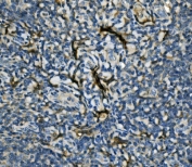 IHC staining of FFPE human tonsil with EIF4A1 antibody. HIER: boil tissue sections in pH8 EDTA for 20 min and allow to cool before testing.