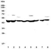 Western blot testing of human 1) placenta, 2) HEK293, 3) A549, 4) HepG2, 5) U-87 MG, 6) rat lung and 7) mouse spleen lysate with EIF4A1 antibody. Predicted molecular weight ~46 kDa.