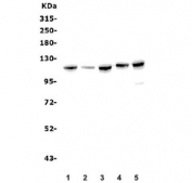Western blot testing of human 1) U-87 MG, 2) A549, 3) PC-3, 4) Caco-2 and 5) K562 lysate with EPHB2 antibody. Predicted molecular weight ~117 kDa.