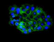 Immunofluorescent staining of FFPE human A431 cells with EPHB2 antibody (green) and DAPI nuclear stain (blue). HIER: steam section in pH6 citrate buffer for 20 min.