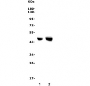 Western blot testing of human 1) placenta and 2) U-87 MG lysate with F2R antibody. Predicted molecular weight ~47 kDa.