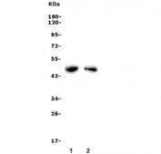 Western blot testing of 1) rat thymus and 2) mouse thymus lysate with Par1 antibody. Predicted molecular weight ~47 kDa.