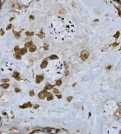 IHC staining of FFPE human placenta with FGA antibody. HIER: boil tissue sections in pH8 EDTA for 20 min and allow to cool before testing.