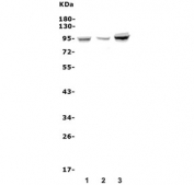 Western blot testing of human 1) T-47D, 2) Caco-2 and 3) SW620 lysate with FGA antibody. Predicted molecular weight ~70 kDa (alpha isoform), ~95 kDa (alpha-E isoform).