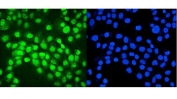 Immunofluorescent staining of FFPE human A431 cells with IRF-1 antibody (green) and DAPI nuclear stain (blue). HIER: steam section in pH6 citrate buffer for 20 min.