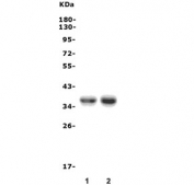 Western blot testing of 1) rat heart and 2) mouse heart lysate with IRF-1 antibody. Expected molecular weight: ~37 kDa (unmodified), 45-50 kDa (modified).