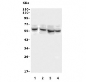 Western blot testing of human 1) Caco-2, 2) Jurkat, 3) HepG2 and 4) A549 cell lysate with DELE antibody. Predicted molecular weight ~56 kDa.