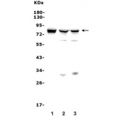 Western blot testing of human 1) HepG2, 2) HeLa and 3) Caco-2 lysate with MASP2 antibody. Predicted molecular weight ~76 kDa.