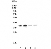 Western blot testing of 1) human U-87 MG, 2) human HEK293, 3) rat PC-12 and 4) mouse Neuro-2a cell lysate with MC4-R antibody. Predicted molecular weight ~37 kDa.