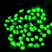 Immunofluorescent staining of FFPE human A431 cells with MORC3 antibody (green). HIER: steam section in pH6 citrate buffer for 20 min.