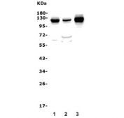 Western blot testing of 1) rat heart, 2) rat liver and 3) mouse heart lysate with MORC3 antibody. Expected molecular weight: 107-130 kDa depending on level of SUMOylation.