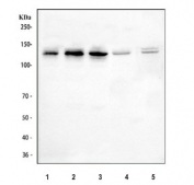Western blot testing of 1) human Caco-2, 2) human HeLa, 3) human SH-SY5Y, 4) rat brain and 5) mouse brain tissue lysate with OFD1 antibody. Predicted molecular weight ~117 kDa.