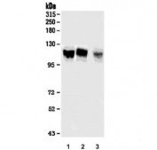 Western blot testing of 1) human HeLa, 2) human Caco-2 and 3) mouse heart lysate with OFD1 antibody. Predicted molecular weight ~117 kDa.