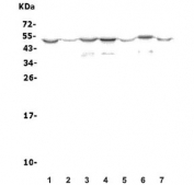 Western blot testing of rat 1) brain, 2) lung, 3) liver, 4) kidney, 5) testis, 6) smooth muscle and 7) C6 cell lysate with Olr1 antibody. Predicted molecular weight: pro-form 35-50 kDa, mature form ~31 kDa.