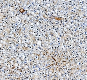 IHC staining of FFPE rat liver with PECAM-1 antibody. HIER: boil tissue sections in pH8 EDTA for 20 min and allow to cool before testing.