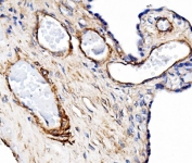 IHC staining of FFPE human placenta with PECAM-1 antibody. HIER: boil tissue sections in pH8 EDTA for 20 min and allow to cool before testing.