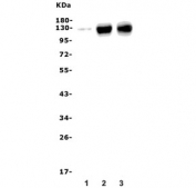 Western blot testing of 1) rat liver, 2) rat lung and 3) mouse lung lysate with PECAM-1 antibody. Expected molecular weight: 83-130 kDa depending on level of glycosylation. 