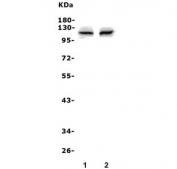 Western blot testing of 1) rat kidney and 2) mouse kidney lysate with Pms2 antibody. Expected molecular weight: 96-110 kDa.