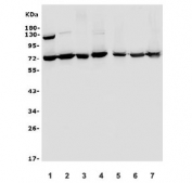 Western blot testing of human 1) Caco-2, 2) HepG2, 3) HeLa, 4) Jurkat, 5) U-87 MG, 6) Raji and 7) HL60 cell lysate with SENP1 antibody. Predicted molecular weight ~73 kDa.
