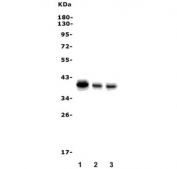 Western blot testing of 1) human K562, 2) human Caco-2 and 3) mouse spleen lysate with SLBP antibody. Expected molecular weight: 31-43 kDa.