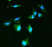 Immunofluorescent staining of FFPE human A549 cells with SLC2A9 antibody (green) and DAPI nuclear stain (blue). HIER: steam section in pH6 citrate buffer for 20 min.