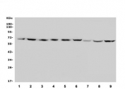 Western blot testing of human 1) HepG2, 2) HEK293, 3) HEK293 (different lot), 4) A549, 5) A431, 6) HeLa, 7) rat kidney, 8) rat liver and 9) mouse RAW264.7 cell lysate with SLC2A9 antibody. Expected molecular weight: 59/56 kDa (L/S forms).