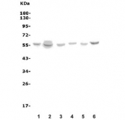 Western blot testing of human 1) HeLa, 2) A549, 3) U-87 MG, 4) A431, 5) HL60 and 6) K562 cell lysate with VMAT1 antibody. Predicted molecular weight ~56 kDa.