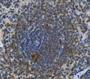 IHC staining of FFPE rat spleen with Toll-like Receptor 1 antibody. HIER: boil tissue sections in pH8 EDTA for 20 min and allow to cool before testing.