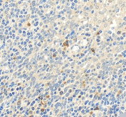 IHC staining of FFPE human tonsil tissue with Toll-like Receptor 1 antibody, HRP-secondary and DAB substrate. HIER: boil tissue sections in pH8 EDTA for 20 min and allow to cool before testing.
