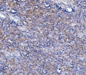 IHC staining of FFPE human tonsil with TRIM6 antibody. HIER: boil tissue sections in pH8 EDTA for 20 min and allow to cool before testing.