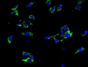 Immunofluorescent staining of FFPE human U-2 OS cells with TRIM6 antibody (green) and DAPI nuclear stain (blue). HIER: steam section in pH6 citrate buffer for 20 min.