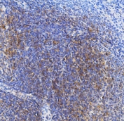 IHC staining of FFPE rat spleen with TRIM6 antibody. HIER: boil tissue sections in pH8 EDTA for 20 min and allow to cool before testing.