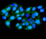 Immunofluorescent staining of FFPE human A431 cells with TTK antibody (green) and DAPI nuclear stain (blue). HIER: steam section in pH6 citrate buffer for 20 min.