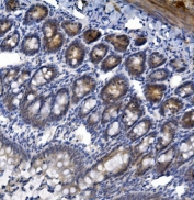 IHC staining of FFPE rat intestine with TTK antibody. HIER: boil tissue sections in pH8 EDTA for 20 min and allow to cool before testing.