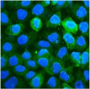Immunofluorescent staining of FFPE human A431 cells with CD59 antibody (green) and DAPI nuclear stain (blue). HIER: steam section in pH6 citrate buffer for 20 min.