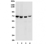 Western blot testing of 1) human Jurkat, 2) human CCR-CEM, 3) mouse spleen and 4) mouse thymus lysate with ZAP70 antibody. Expected molecular weight ~70 kDa.