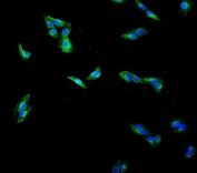 Immunofluorescent staining of FFPE human A431 cells with Tubulin Beta antibody (green) and DAPI nuclear stain (blue). HIER: steam section in pH6 citrate buffer for 20 min.